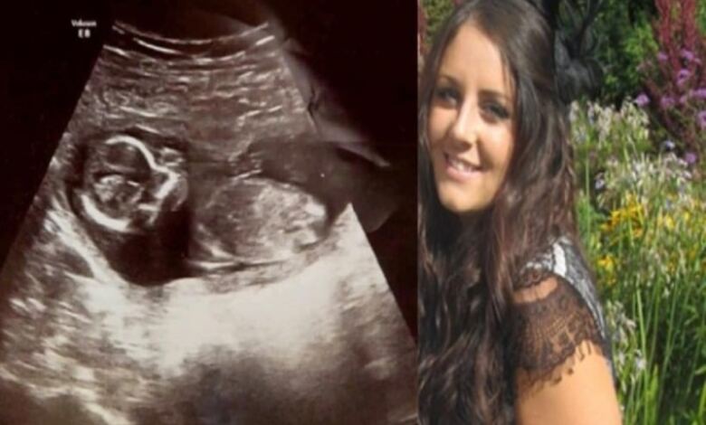 Photo of Δέκα μέρες μετά την έκτρωση πήγε στο γιατρό για εξετάσεις – Σοκαρισμένοι δεν πίστευαν ότι το μωρό…