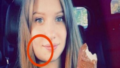 Photo of Μια 24χρονη ξύπνησε και είδε το σαγόνι της πρησμένο – Μόλις πήγε στο νοσοκομείο…Ανατριχιαστικό!