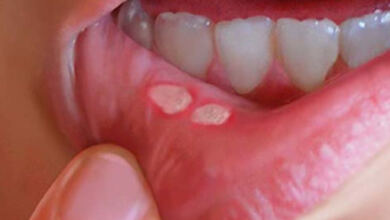 Photo of Ποιά είναι τα ύπουλα σημάδια του καρκίνου του στόματος!