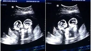 Photo of Έγκυος πήγε για υπερηχογράφημα – Μόλις κοίταξε την οθόνη πάγωσε