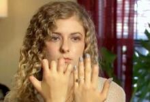 Photo of 27χρονη Χάνει Ξαφνικά Τα Δάχτυλά Της Σήμερα Προειδοποιεί Όλες Τις Γυναίκες Για Αυτόν Κίνδυνο -ΒΙΝΤΕΟ
