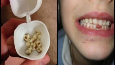 Photo of Οι γιατροί στέλνουν επείγον μήνυμα σε όλους τους γονείς να μην πετάξουν τα πρώτα δόντια των παιδιών τους