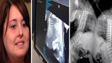 Photo of 27χρονη έγκυος πήγε να κάνει υπερηχογράφημα – Όταν το είδαν οι γιατροί πάγωσαν και της είπαν να το ρίξει (Video)