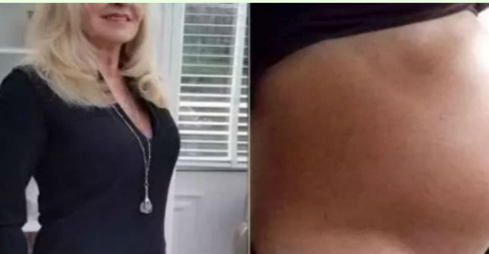 Photo of 66χρονη πήγε στο νοσοκομείο νομίζοντας πως είναι έγκυος – Όταν οι γιατροί της είπαν την αλήθεια «πάγωσε»