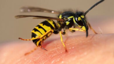 Photo of Τι κάνουμε για τσίμπημα μέλισσας και τι για σφήκας (σφίγγας ή σφήγκας). Πώς να αφαιρέσετε το κεντρί; Αντιμετώπιση αλλεργικής αντίδρασης