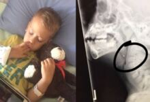 Photo of 6χρονο αγοράκι έφαγε ένα κοτόπουλο και άρχισε να έχει πόνους στο λαιμό – “Πάγωσαν” όταν είδαν τα αποφάγια