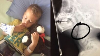 Photo of 6χρονο αγοράκι έφαγε ένα κοτόπουλο και άρχισε να έχει πόνους στο λαιμό – “Πάγωσαν” όταν είδαν τα αποφάγια