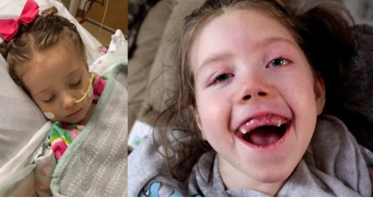 Photo of 4χρονη έπαθε εγκεφαλική βλάβη από αποσμητικό, γιατί η μητέρα της έκανε ένα λάθος που κάνουν πολλοί γονείς