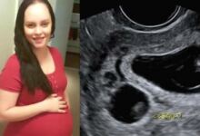 Photo of Σοκ 31χρονη έμεινε έγκυος σε δίδυμα – Αλλά το ένα δεν είναι δικό της παιδί! (Video)