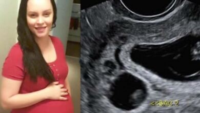Photo of Σοκ 31χρονη έμεινε έγκυος σε δίδυμα – Αλλά το ένα δεν είναι δικό της παιδί! (Video)