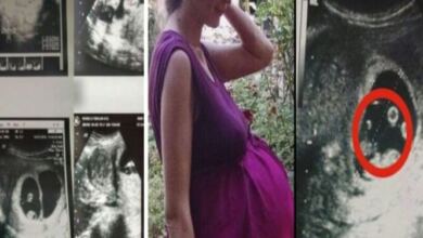 Photo of Όταν οι γιατροί είδαν το υπερηχογράφημα 36χρονης εγκύου φοβήθηκαν να την αγγίξουν – Δεν είχαν αντιμετωπίσει ποτέ κάτι παρόμοιο