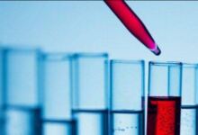 Photo of Εξετάσεις αίματος: Να τι σημαίνει κάθε εξέταση στη γενική αίματος και τι να κοιτάς