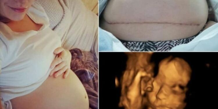 Photo of 26χρονη μητέρα γέννησε πρόωρα μωρό – Αυτό που έκαναν μετά οι γιατροί θα σας αφήσει άφωνους