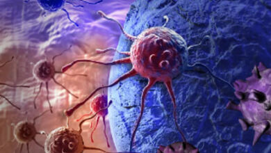Photo of Αυτός είναι ο Νο1 φονικός καρκίνος του 21ου αιώνα – Η κύρια αιτία πρόκλησής του