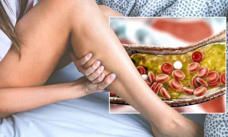 Photo of Χοληστερόλη: Τα σημάδια στα πόδια που μαρτυρούν ότι είναι στα ύψη