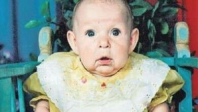 Photo of Το πρόσωπο αυτού του μωρού άλλαζε από μέρα σε μέρα – Μόλις οι γιατροί κατάλαβαν το γιατί…