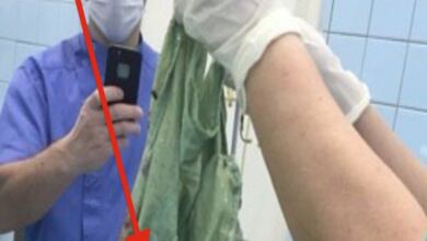 Photo of Η κοιλιά της 34χρονης δεν σταματούσε να μεγαλώνει – Όταν την άνοιξαν οι γιατροί, έπαθαν σοκ