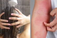 Photo of Μην το κάνετε!: Τέλος το καθημερινό μπάνιο – Οι σοβαροί κίνδυνοι για το σώμα και τι λένε οι δερματολόγοι