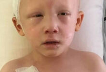 Photo of Ψιθύρισε 3 λέξεις και τους “πάγωσε” όλους: 3χρονο αγοράκι με καρκίνο ανοίγει τα μάτια του για τελευταία φορά