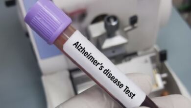 Photo of Αλτσχάιμερ: Απλή εξέταση αίματος ανιχνεύει με ακρίβεια τη νόσο στα πιο αρχικά στάδιά της