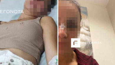 Photo of Βόλος: Διεθνής αθλητής χτύπησε την πρώην σύζυγό του μπροστά στο παιδί τους -Σοκάρουν οι φωτογραφίες