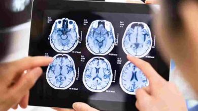 Photo of Το νο.1 σύμπτωμα όγκου στον εγκέφαλο για το οποίο οι περισσότεροι απλά δεν δίνουν σημασία