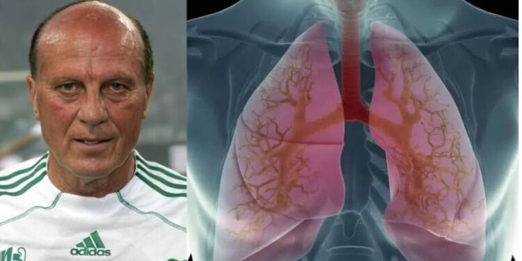 Αυτή είναι η αιτία θανάτου του Μίμη Δομάζου! Πως θα το αντιμετωπίσετε