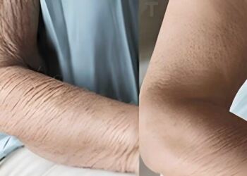 Πώς να φροντίσετε το δέρμα που γερνάει