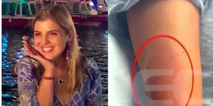 Μαρίσσα Λαιμού: Αυτή είναι η αιτία θανάτου σύμφωνα με την ιατροδικαστική εξέταση – Η οργή της οικογένειας και οι αποκαλύψεις για το μοιραίο τσίμπημα