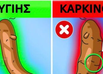 Τι αποκαλύπτει το χρώμα των κοπράνων σας για την υγεία σας