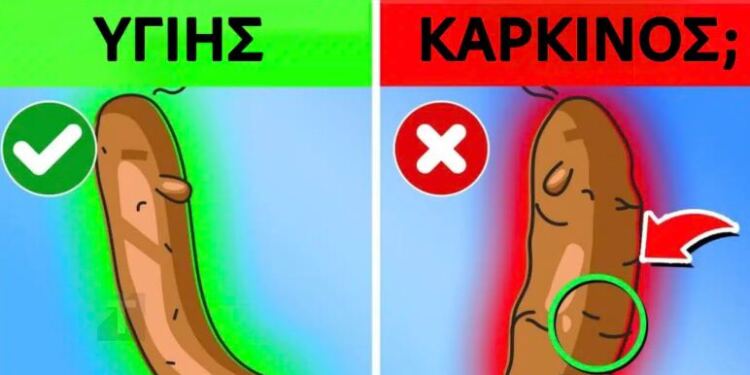 Τι αποκαλύπτει το χρώμα των κοπράνων σας για την υγεία σας