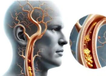1 βιταμίνη σταματά τη συσσώρευση ασβεστίου στις αρτηρίες και την καρδιά
