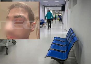 Αίγιο: Πέθανε ο 43χρονος ασθενής μποξέρ που γρονθοκόπησε γιατρό – Τι λέει ο ορθοπεδικός για την επίθεση