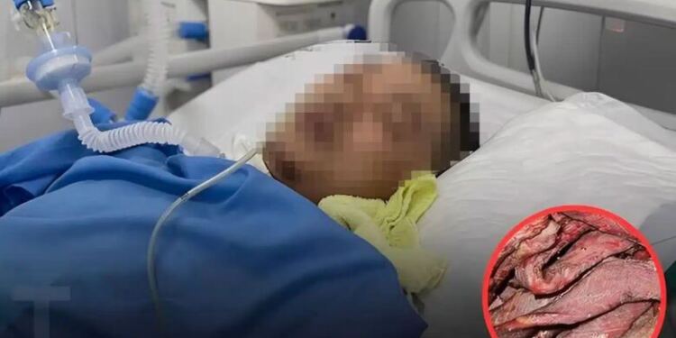 Γιατί η κατανάλωση περισσότερου από αυτό το κρέας μπορεί να σας βάζει σε κίνδυνο