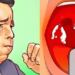 Έχετε συνεχώς βλέννα στον λαιμό; Αυτό σημαίνει Τι την προκαλεί και πότε πρέπει να σας ανησυχεί