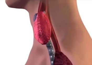 Σταματήστε να τρώτε αμέσως αυτά τα 6 τρόφιμα που χειροτερεύουν τον θυρεοειδή