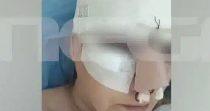 Εμπορικό Κέντρο Θεσσαλονίκης: «Σπασμένη μύτη, πλευρό, πάνω από 100 ράμματα»