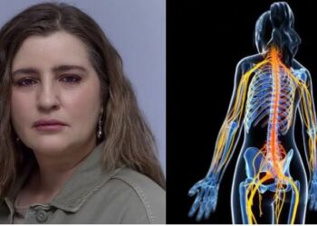 Τι είναι το αυτοάνοσο «ινομυαλγία» που έχει η Μαρία Κίτσου;