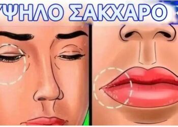 12 σημάδια ότι το σάκχαρό σας είναι πολύ υψηλό